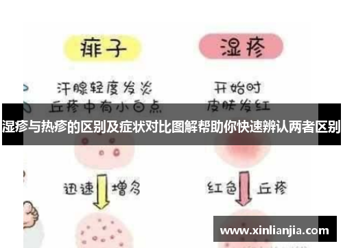 湿疹与热疹的区别及症状对比图解帮助你快速辨认两者区别